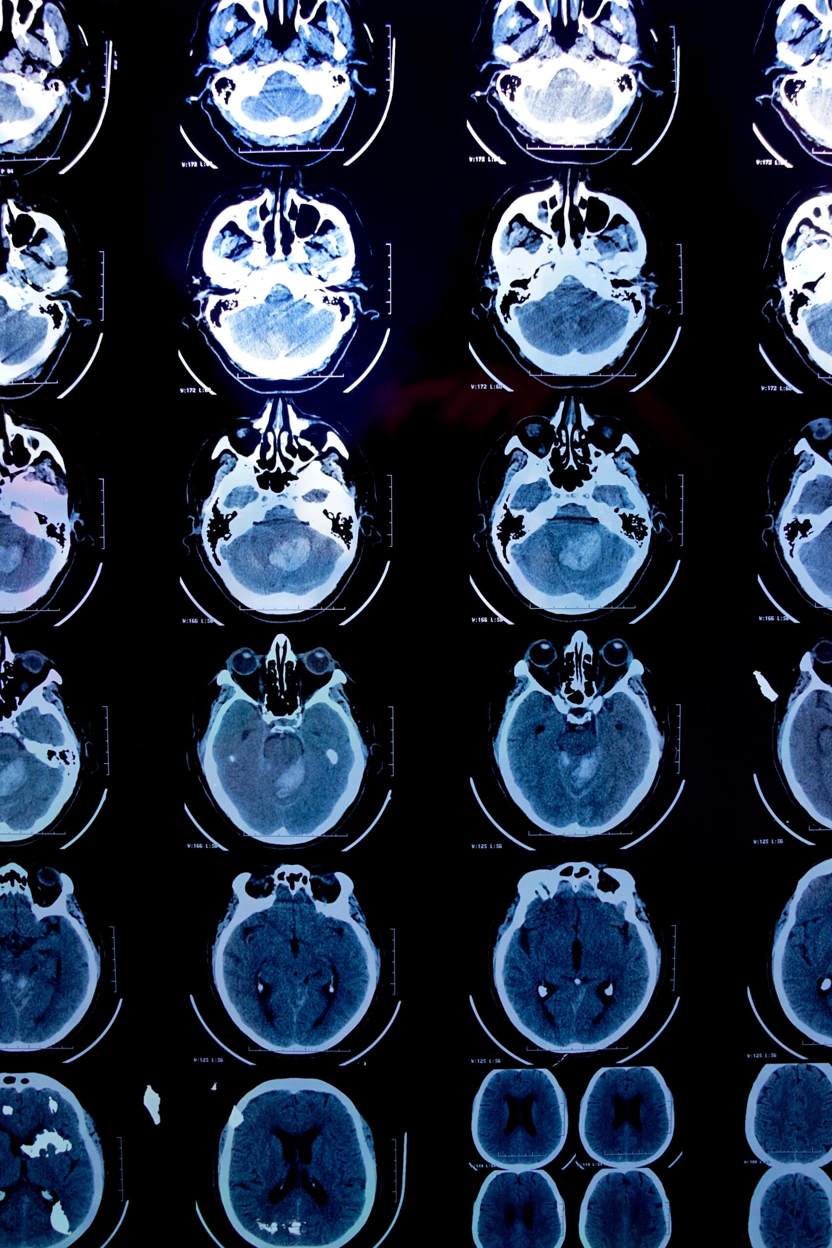 radiology-medical-imaging-2022-10-04-16-58-34-utc-min